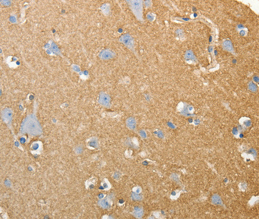 SLC4A4 Polyclonal Antibody – Figure 1 of 3