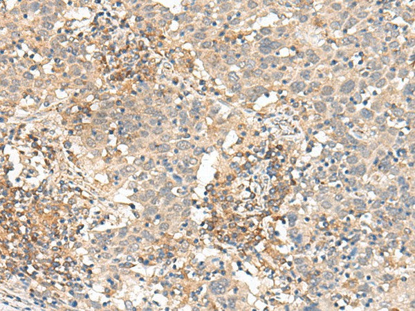 SLC40A1 Polyclonal Antibody – Figure 1 of 2
