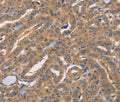 CDCA4 Polyclonal Antibody – Figure 1 of 3