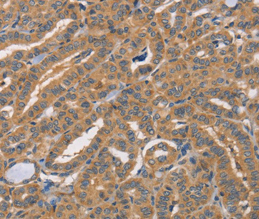 CDCA4 Polyclonal Antibody – Figure 1 of 3