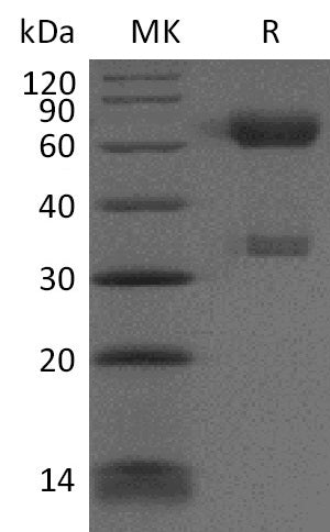 Recombinant Cynomolgus PD-1/CD279/PDCD1 Protein (Fc Tag) – Figure 1 of 2