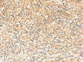 UBD Polyclonal Antibody – Figure 1 of 3