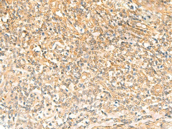 UBD Polyclonal Antibody – Figure 1 of 3