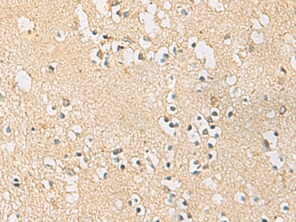 PDE4DIP Polyclonal Antibody – Figure 1 of 2