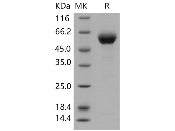 Recombinant Human DDR1 Kinase/MCK10 Protein (His Tag) – Figure 1 of 2