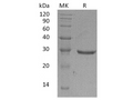 Recombinant Human GLIPR1 Protein (His Tag) – Figure 1 of 2