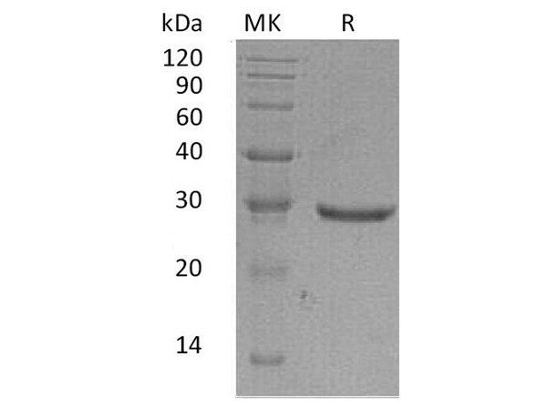 Recombinant Human GLIPR1 Protein (His Tag) – Figure 1 of 2