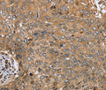 CLEC16A Polyclonal Antibody – Figure 1 of 3