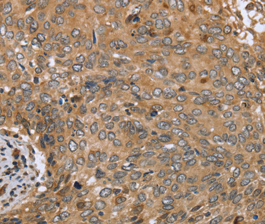 CLEC16A Polyclonal Antibody – Figure 1 of 3
