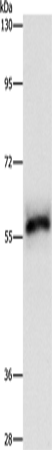 HCK Polyclonal Antibody – Figure 1 of 2