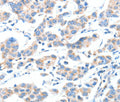 XBP1 Polyclonal Antibody – Figure 1 of 3