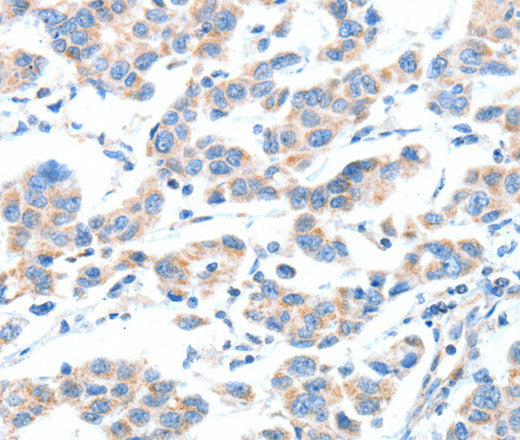 XBP1 Polyclonal Antibody – Figure 1 of 3