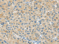 ABCC2 Polyclonal Antibody – Figure 1 of 2