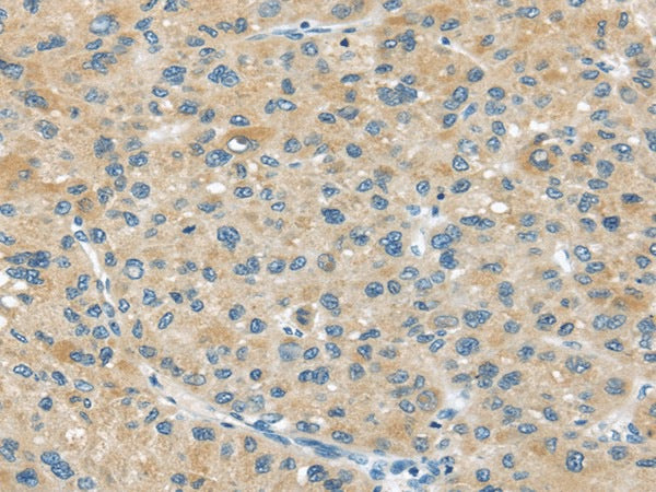 ABCC2 Polyclonal Antibody – Figure 1 of 2