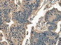 DNAJC2 Polyclonal Antibody – Figure 1 of 3