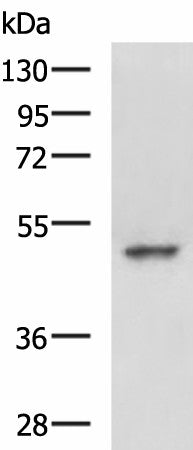 MYCN Polyclonal Antibody – Figure 1 of 2