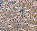 EDA Polyclonal Antibody – Figure 1 of 3