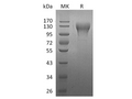 Recombinant Human CD96 Protein (His Tag) – Figure 1 of 2