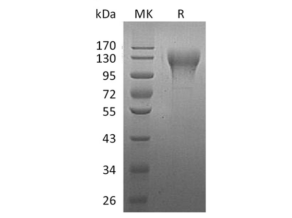 Recombinant Human CD96 Protein (His Tag) – Figure 1 of 2