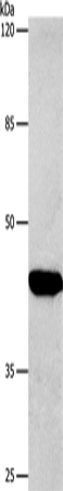 CTGF Polyclonal Antibody – Figure 1 of 3