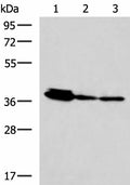 EEF1D Polyclonal Antibody – Figure 1 of 4