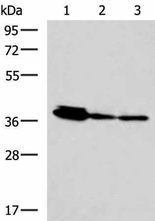 EEF1D Polyclonal Antibody – Figure 1 of 4