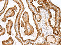 SAXO2 Polyclonal Antibody – Figure 1 of 2