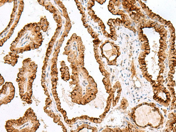 SAXO2 Polyclonal Antibody – Figure 1 of 2