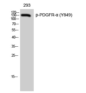 Phospho-PDGFRA (Tyr849) Polyclonal Antibody – Figure 1 of 2