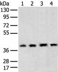 TBP Polyclonal Antibody – Figure 1 of 2