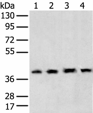 TBP Polyclonal Antibody – Figure 1 of 2