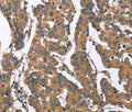 BNIP2 Polyclonal Antibody – Figure 1 of 3