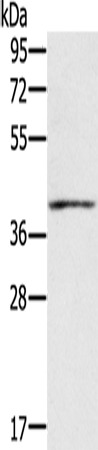 IFNGR2 Polyclonal Antibody – Figure 1 of 4