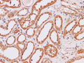 IP3KB Polyclonal Antibody – Figure 1 of 3