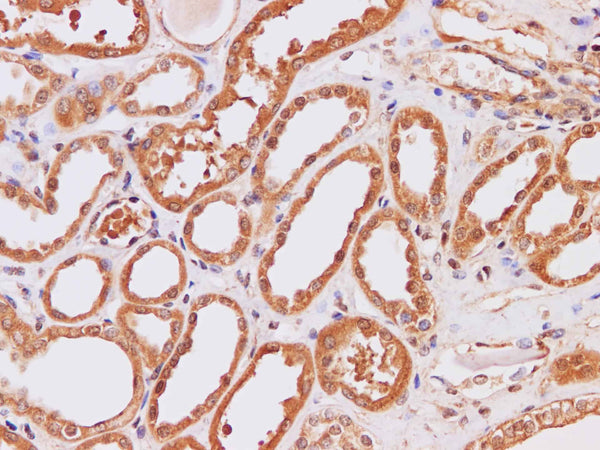 IP3KB Polyclonal Antibody – Figure 1 of 3