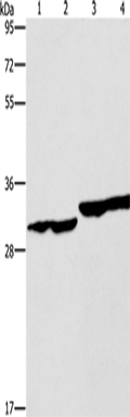 DECR1 Polyclonal Antibody – Figure 1 of 4
