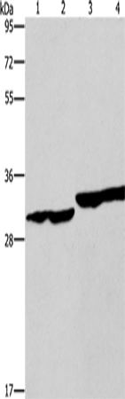 DECR1 Polyclonal Antibody – Figure 1 of 4
