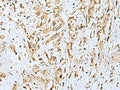 HOXC9 Polyclonal Antibody – Figure 1 of 2