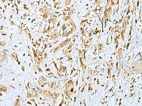 HOXC9 Polyclonal Antibody – Figure 1 of 2
