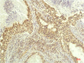 p70 S6 kinase alpha Monoclonal Antibody – Figure 1 of 3