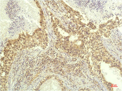 p70 S6 kinase alpha Monoclonal Antibody – Figure 1 of 3