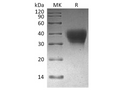Recombinant Cynomolgus PD-1/CD279/PDCD1 Protein (His Tag) – Figure 1 of 2