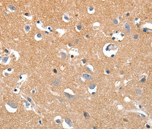 LRP3 Polyclonal Antibody – Figure 1 of 2