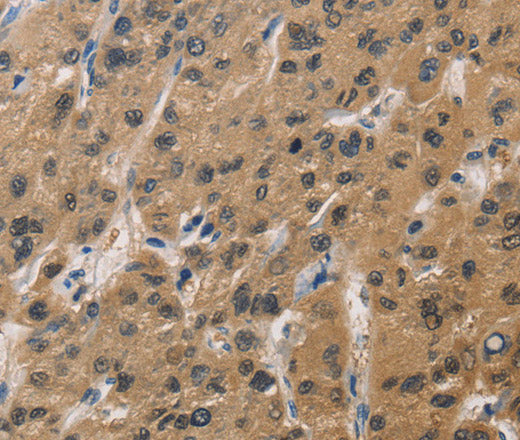 DUSP26 Polyclonal Antibody – Figure 1 of 3