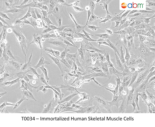 Immortalized Human Skeletal Muscle Cells | Applied Biological Materials (abm)