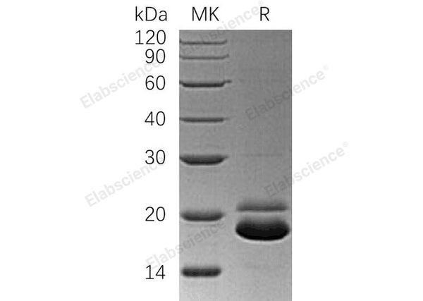 Recombinant Human TRAIL R2/TNFRSF10B Protein (His Tag) – Figure 1 of 2