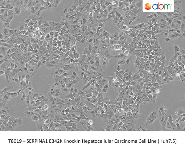 SERPINA1 E342K Knockin Hepatocellular Carcinoma Cell Line (Huh7.5) | Applied Biological Materials (abm)