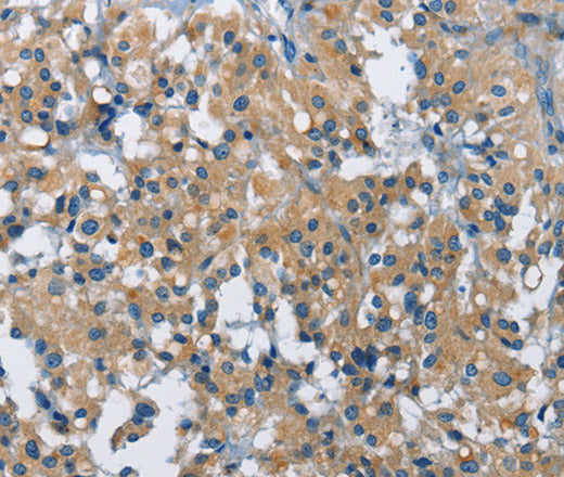 BMPR1B Polyclonal Antibody – Figure 1 of 3