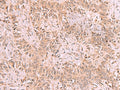 RRP8 Polyclonal Antibody – Figure 1 of 3