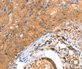 ACOX3 Polyclonal Antibody – Figure 1 of 3
